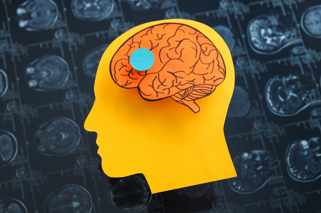 Everything You Need to Know About Dementia Types When Considering Memory Care