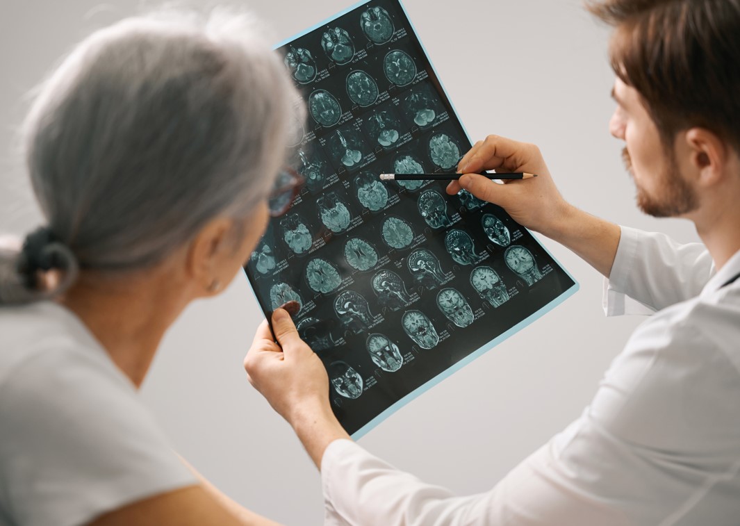 What's the difference between Alzheimer's and Lewy Body Dementia? Legacy at Savannah Quarters