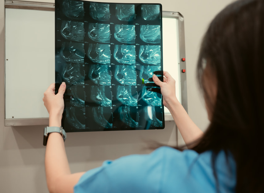 Healthcare professional reviewing breast imaging scans on a lightbox, illustrating breast cancer screening, mammogram evaluations, and early detection considerations for women over 70.
